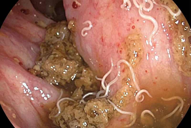 2. Targets Parasites Most People Don't Know They Have